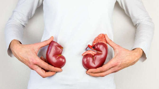 Would you sell your kidney for 2 million dollars?