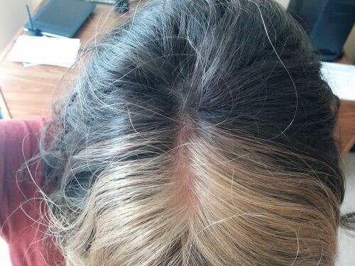 Is it likely I have a black gene too?