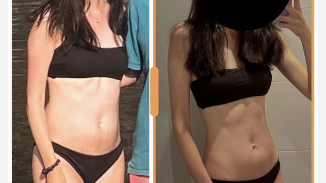 Is my weight loss too obvious?