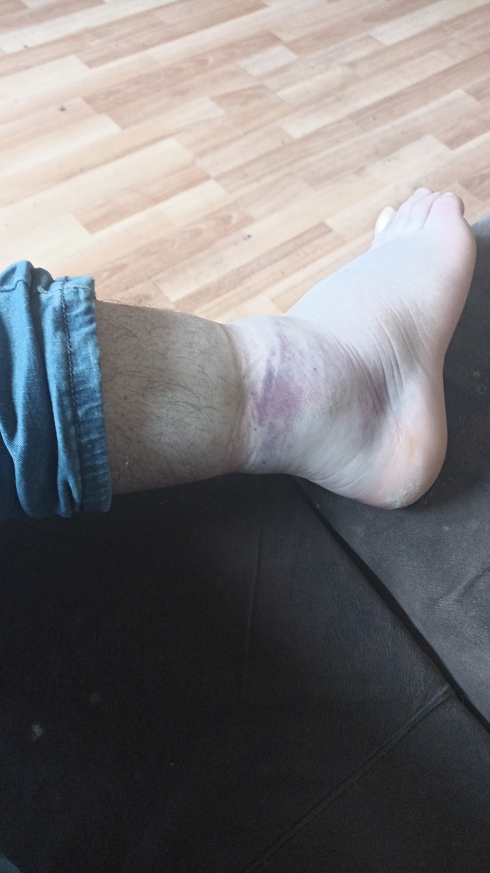Does my foot look bad?