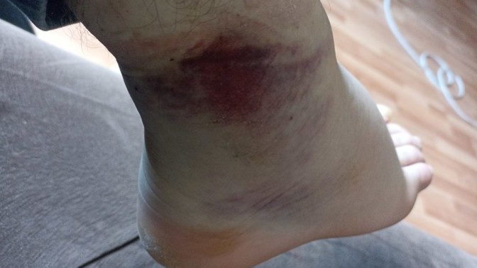 Does my foot look bad?