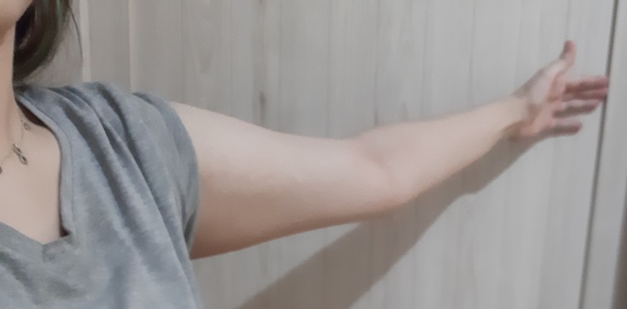 How to get rid of flabby arms? And how to lose weight without getting loose skin?