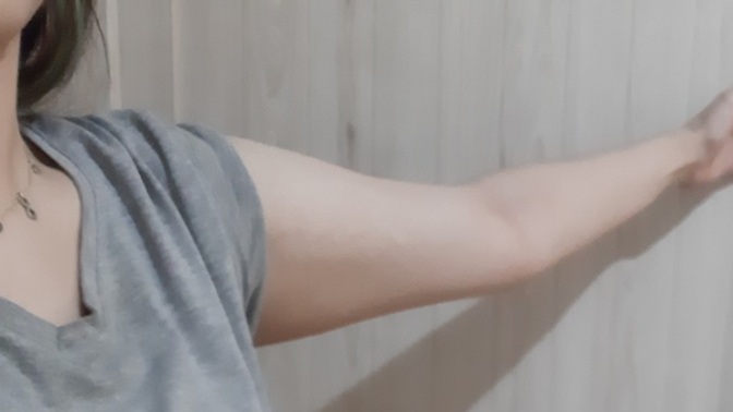 How to get rid of flabby arms? And how to lose weight without getting loose skin?