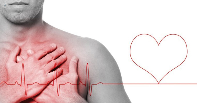 Are blood pressure monitors usually fairly accurate?