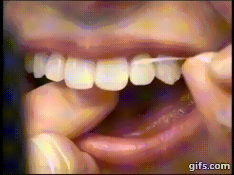 Did you ever get floss stuck in your teeth?
