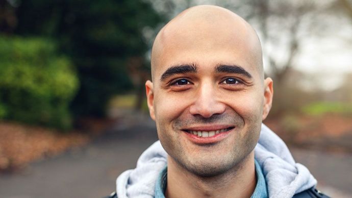 If your husband/bf/wife/gf lost all their hair permanently, would you still find them really attractive?