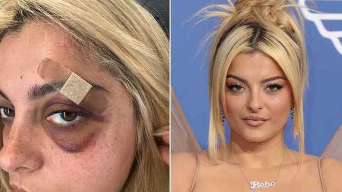 What do you think of people that attack performers at concerts?