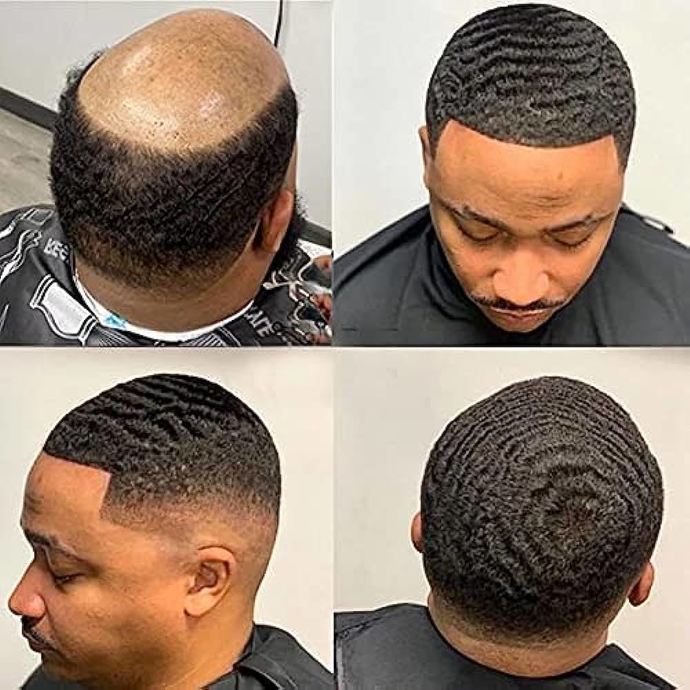 What's a good hairstyle for a guy with male pattern baldness?