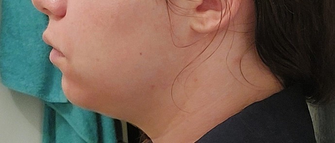 Weak chin or just fat?