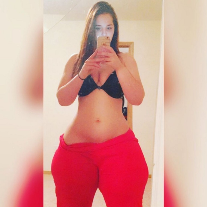 What do guys think of a woman with Lipoedema?