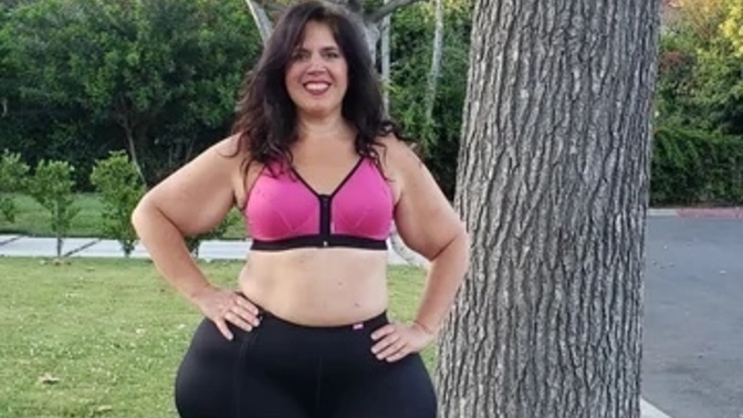 What do guys think of a woman with Lipoedema?