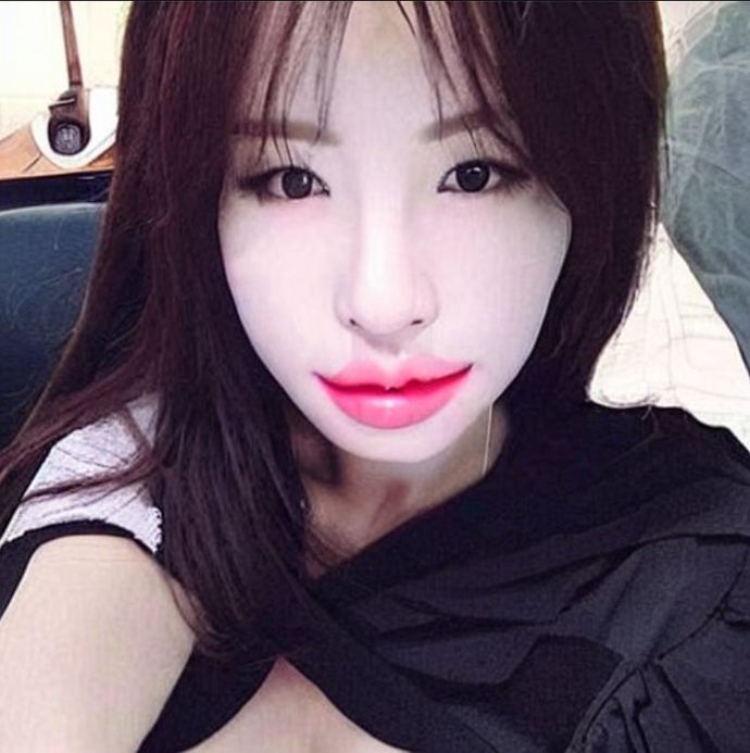 Did the light cosmetic procedures make this Korean model look beautiful, in your opinion?