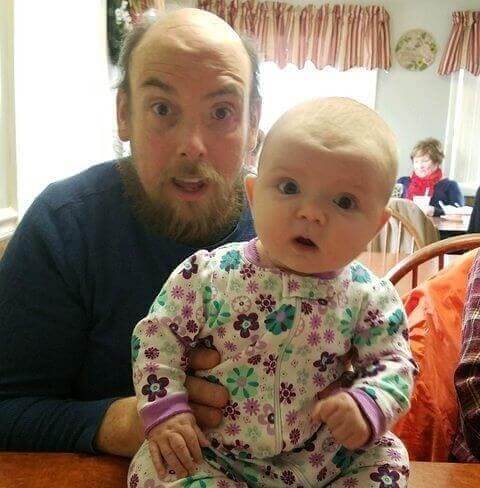 Father and daughter with some forehead dimple