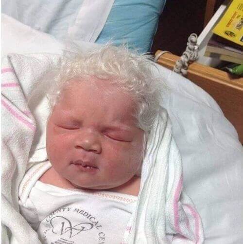 Baby born with full head of white hair which is extremely rare