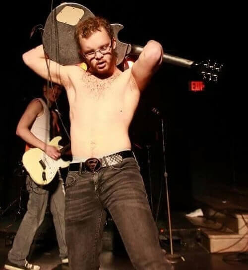 Born without nipples