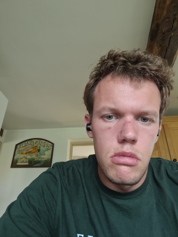 Am I just too ugly for a girl to like me? GirlsAskGuys