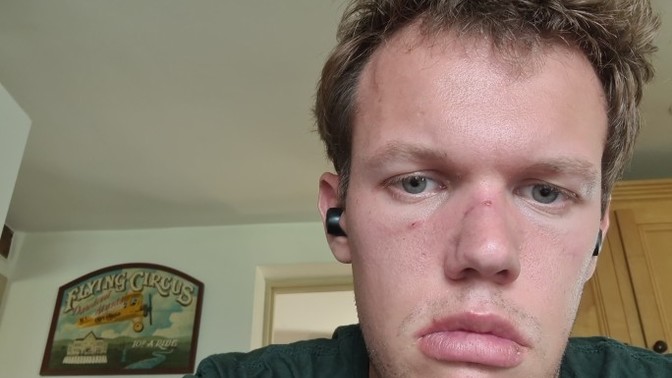 Am I just too ugly for a girl to like me?