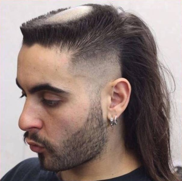 What is the worst hairstyle a man can have?
