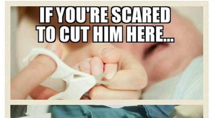 Why are women terrified of accidentally cutting their babies fingers but feel no remorse circumcizing them?