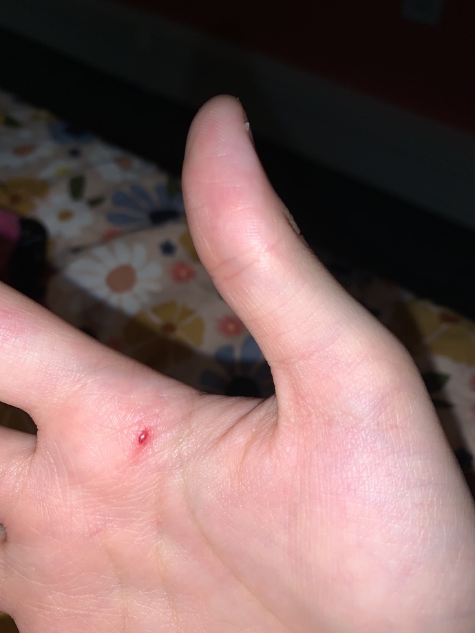 Whats This Red Spot?