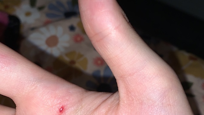 Whats This Red Spot?