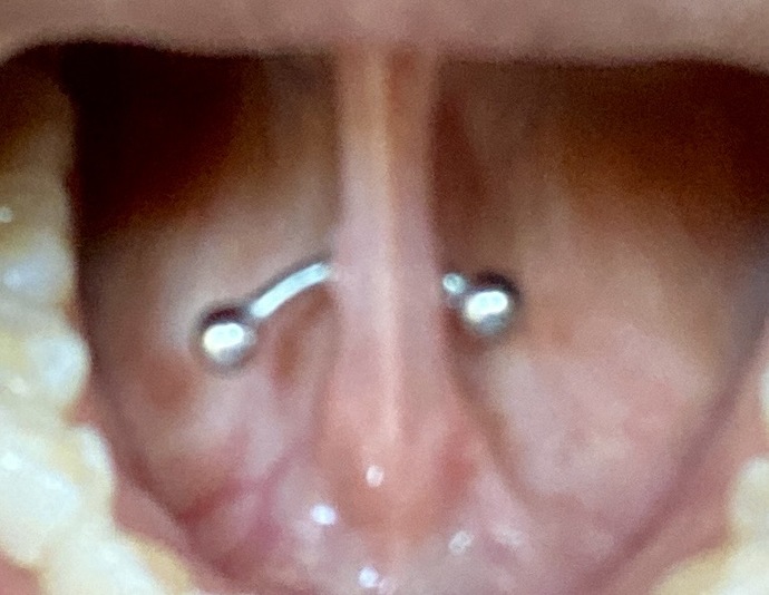 Are tongue piercings hot and attractive? What do you all think?