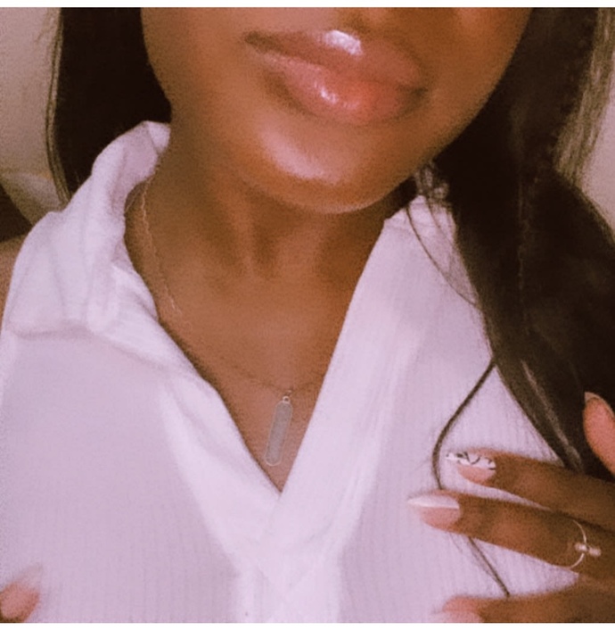 Should I get lips like this when I get my lip filler?