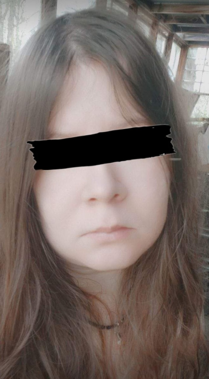 How to have a clear smooth face without pimples and acnes?