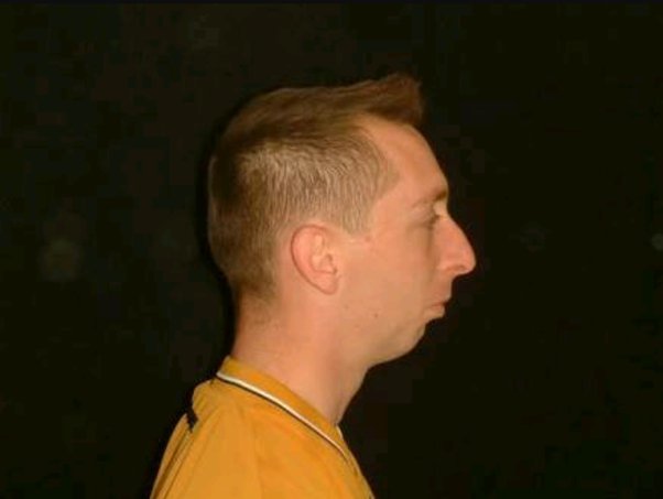 Is there something we can do to get a good jawline?