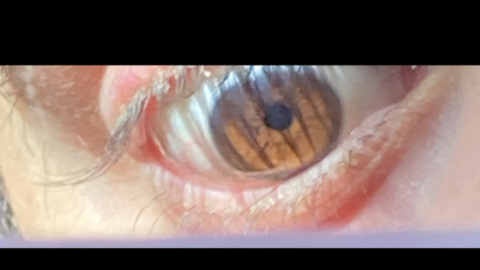 What color is me eye?