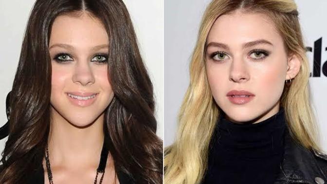 Do you think this female celebrity looked better before or after plastic surgery?