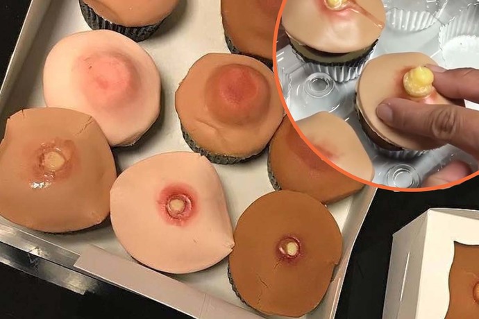 Couples… Pimple-Popping… WHY?