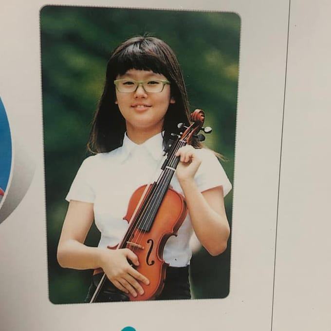 Did she get plastic surgery?