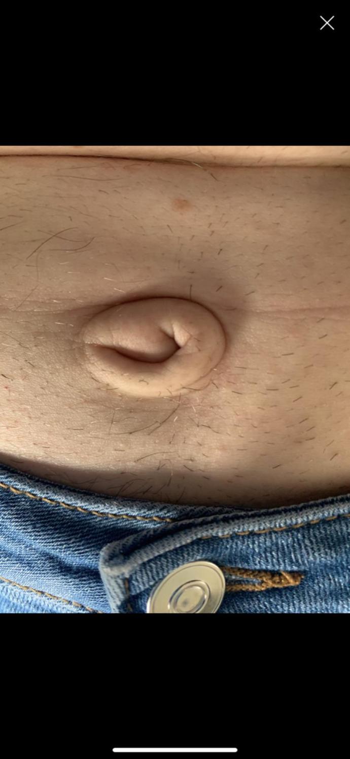How do you feel about outie belly buttons?