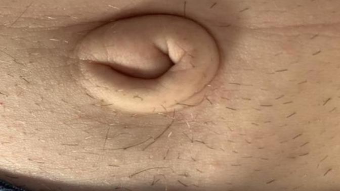 How do you feel about outie belly buttons?