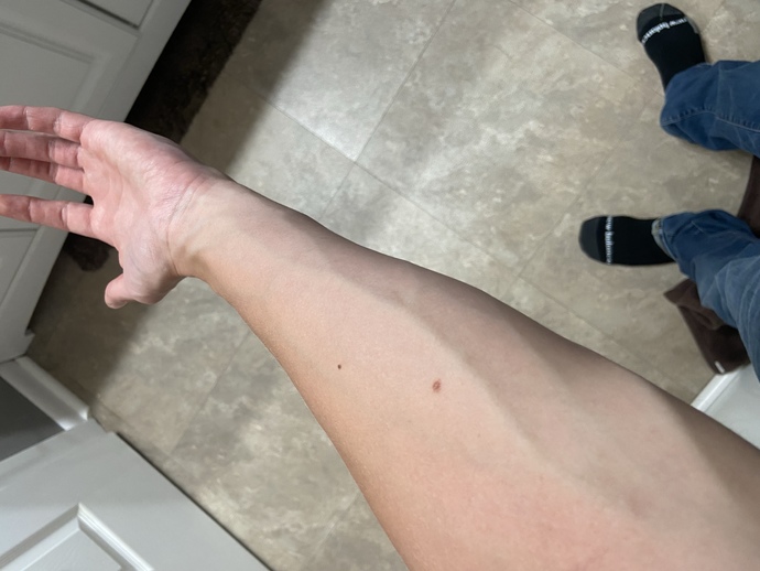 Are defined forearm veins attractive or unattractive?
