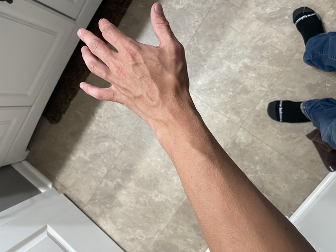 Are defined forearm veins attractive or unattractive? GirlsAskGuys