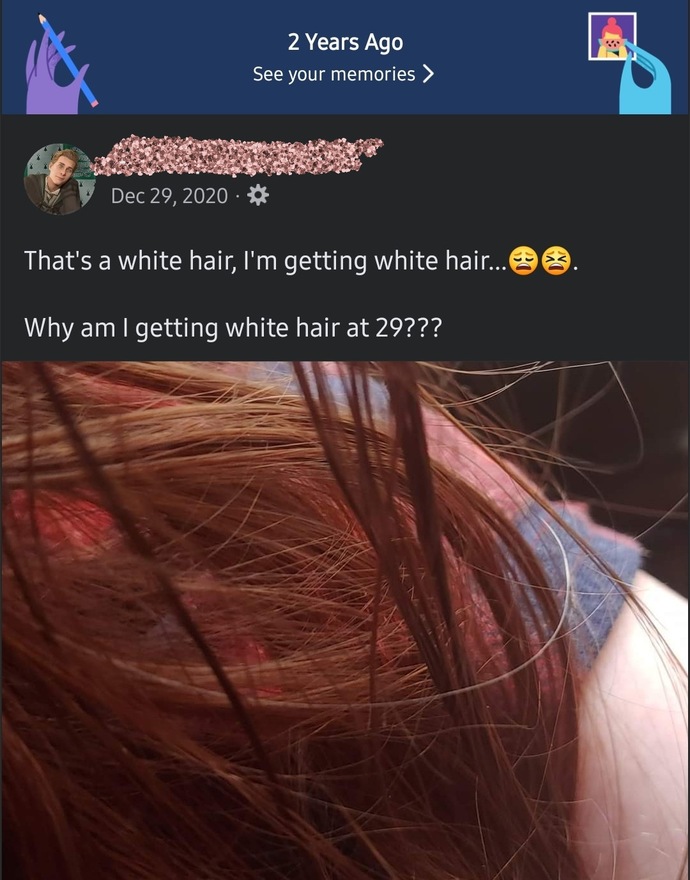 Wheat age did you start to notice gray hair and what was your reaction?