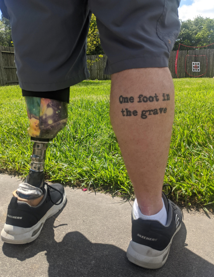 Have you ever dated someone with a wooden leg?