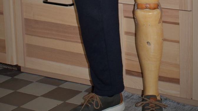 Have you ever dated someone with a wooden leg?