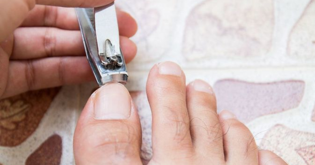 How OFTEN do you TRIM your TOENAILS? GirlsAskGuys