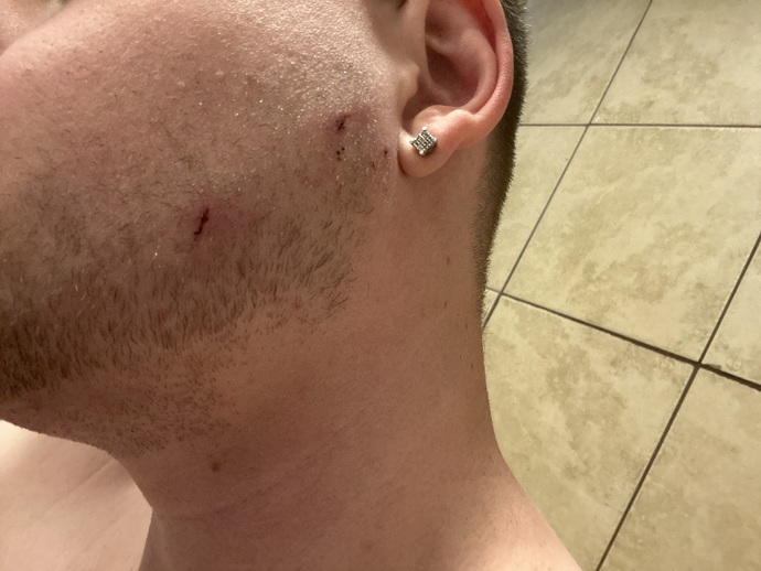 Ever been attacked by a dog?