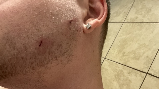 Ever been attacked by a dog?