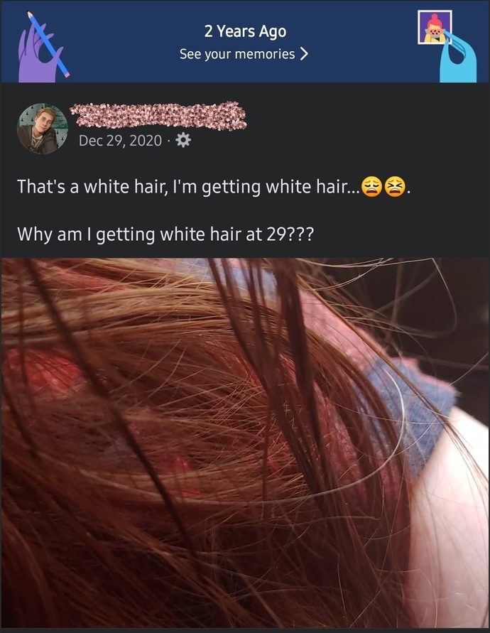 I found my first grey hair today in my 30s and stressing out over it, how did you guys and gals deal with it if it's happening to you?