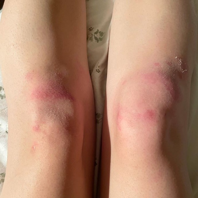 Do you find knees of women beautiful and sexy?