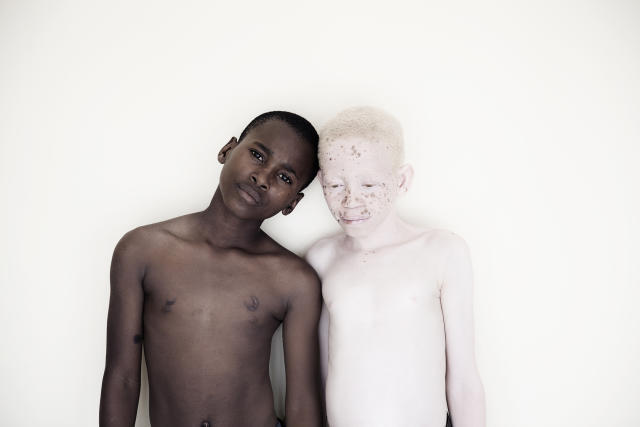 When it comes to skin color, would you change it?