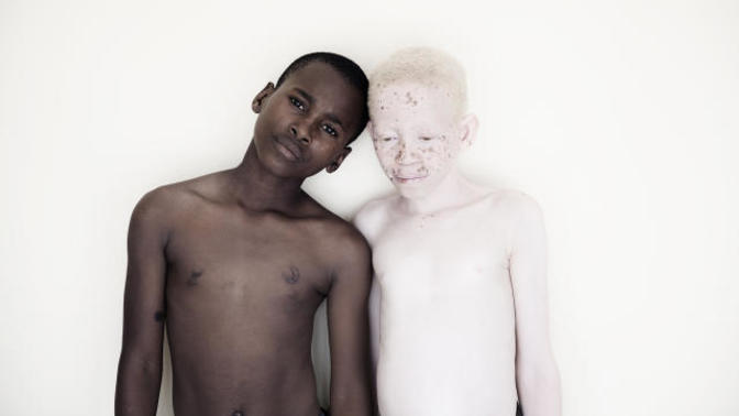 When it comes to skin color, would you change it?