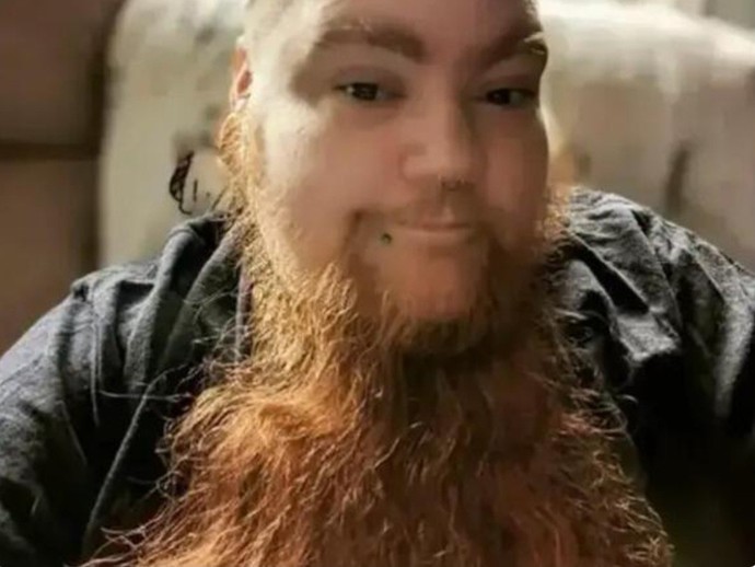 What do you think about the woman who broke the record for having the longest beard due to pcos?