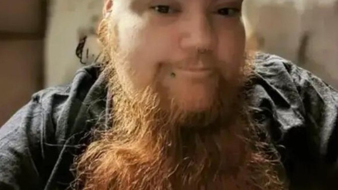 What do you think about the woman who broke the record for having the longest beard due to pcos?