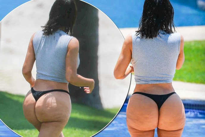 Do guys hate cellulite?